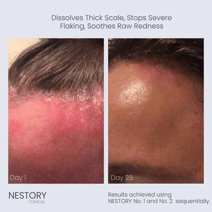 Cellular Reset Protocol
